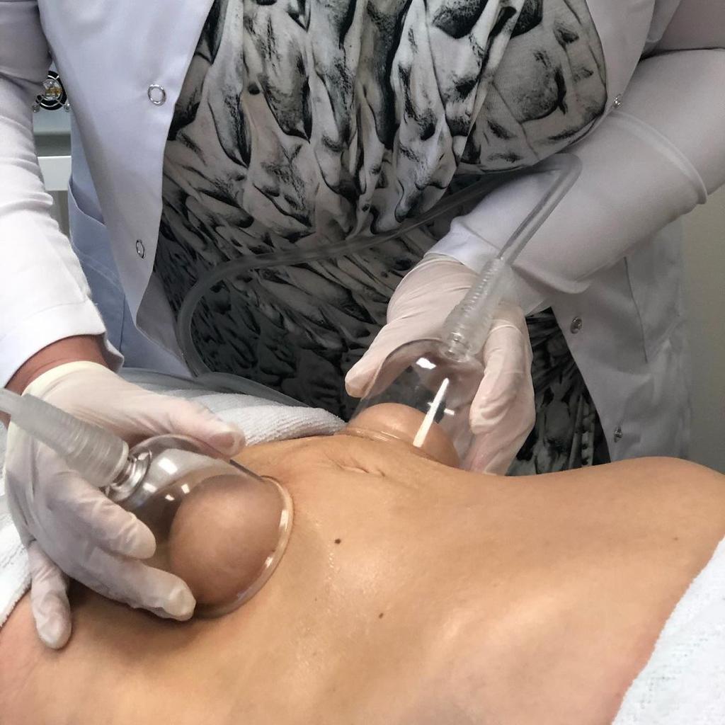 Clearance Curv Vacuum and Cupping Therapy