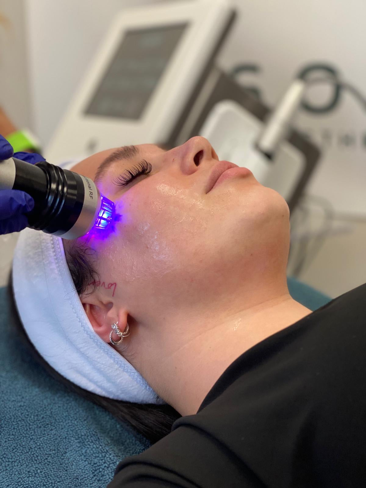 Clearance Goldskin Fractional Micro Needle RF
