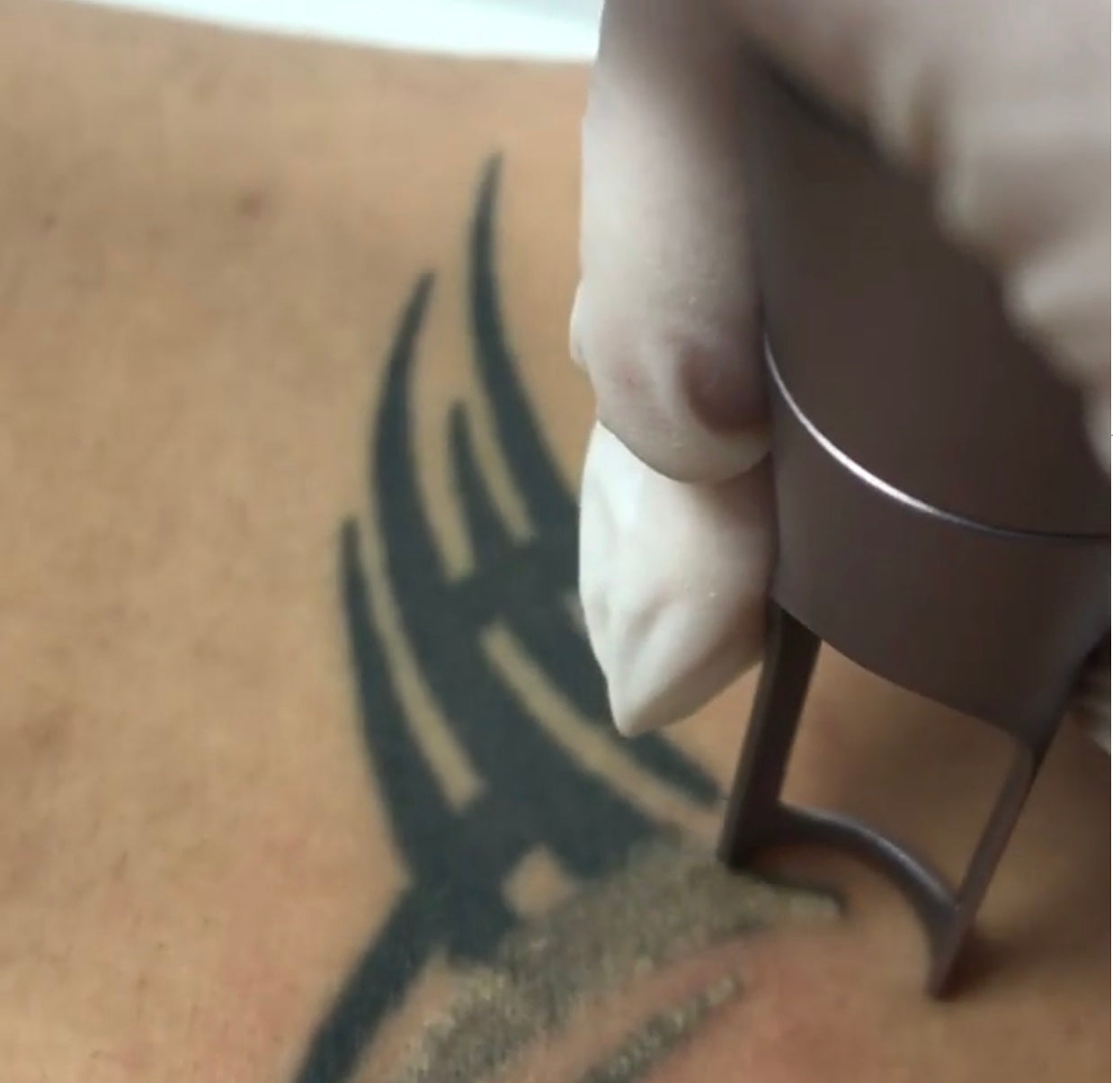 Cobra Ink Tattoo Removal System