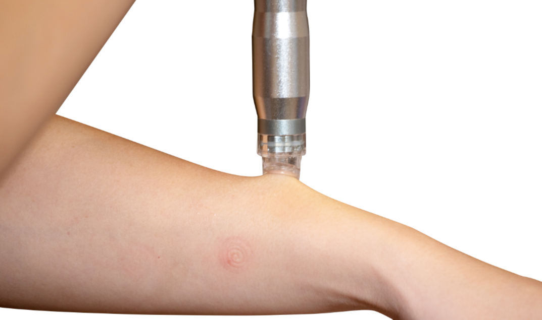 Tru Hydro 2-in-1 Hydrodermabrasion and Microdermabrasion