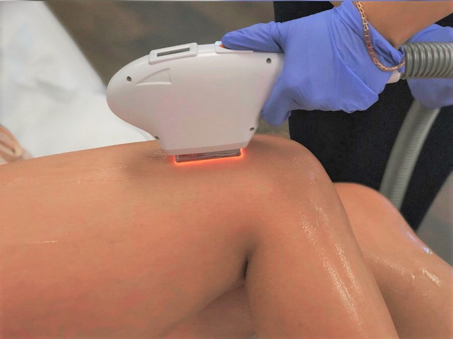The Medi Next Advanced IPL Hair Removal and Skin Rejuvenation