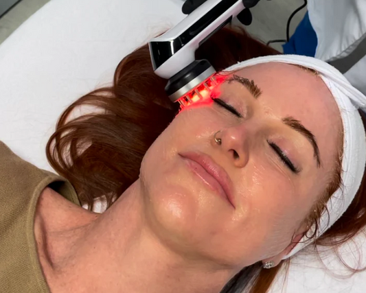 Why Hyperpigmentation Becomes More Common After 35