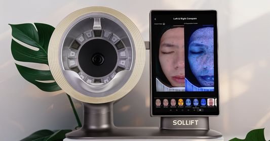 skin analyzer aesthetic device