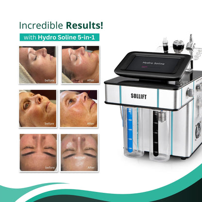 Hydro Soline 5-in-1 Skin Rejuvenation Facial Expert