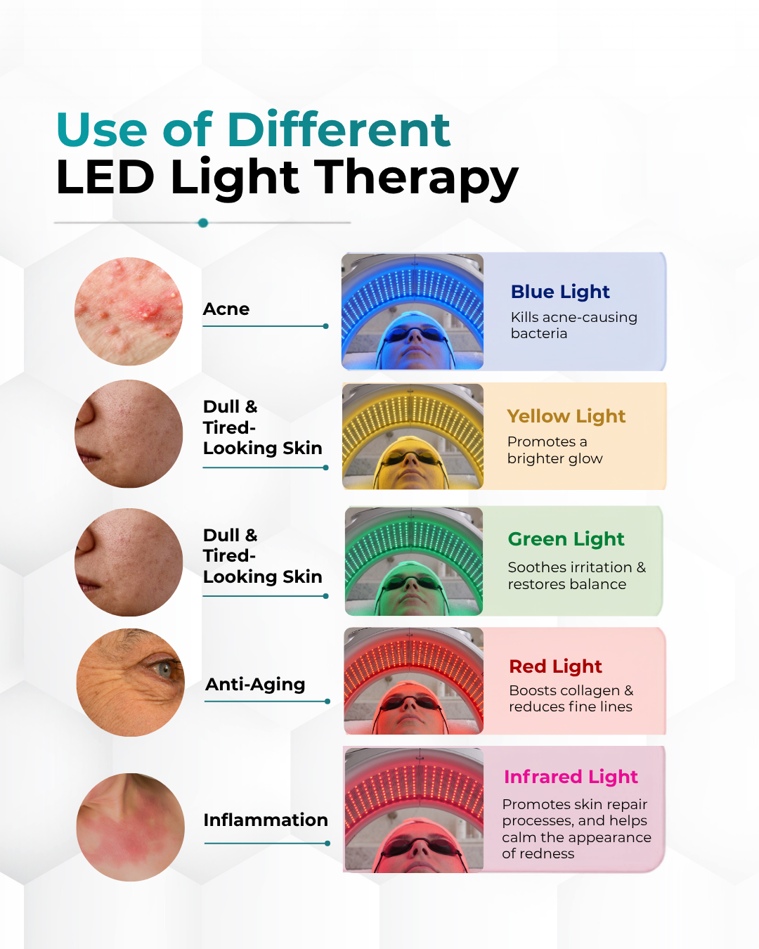 LunaSol LED Light Therapy: Face and Body