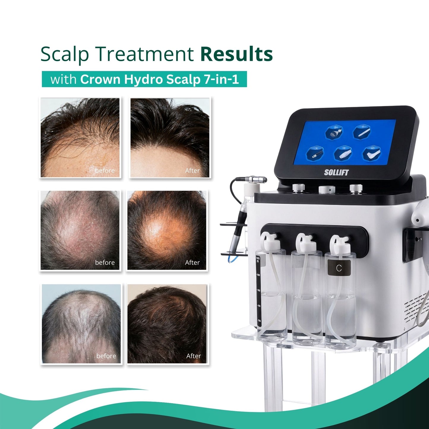 Crown Hydro Scalp 7-in-1 Hair Treatment