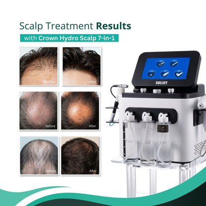 Crown Hydro Scalp 7-in-1 Hair Treatment