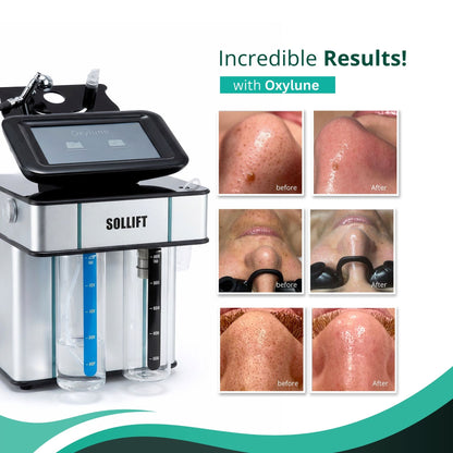 Oxylune - Hydrodermabrasion and Oxygen Infusion Device