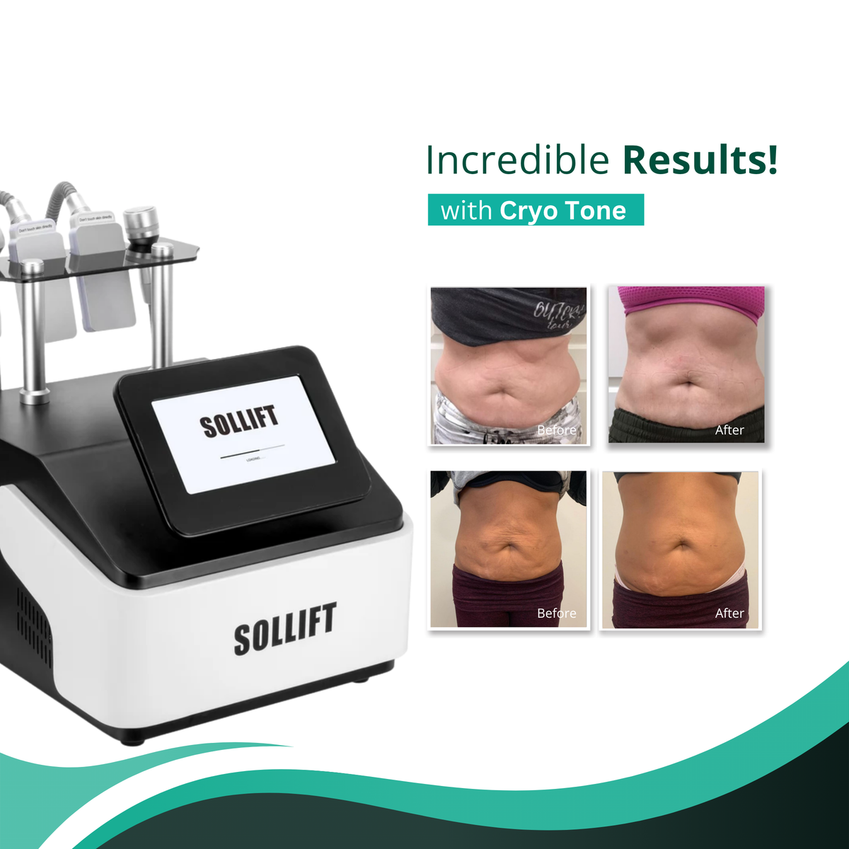 Cryo Tone Face and Body Contouring