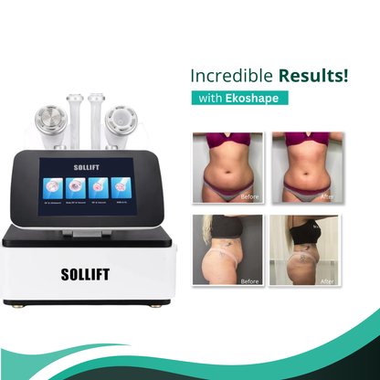 4-in-1 Ekoshape Body Sculpting Device with Cavitation and Vacuum