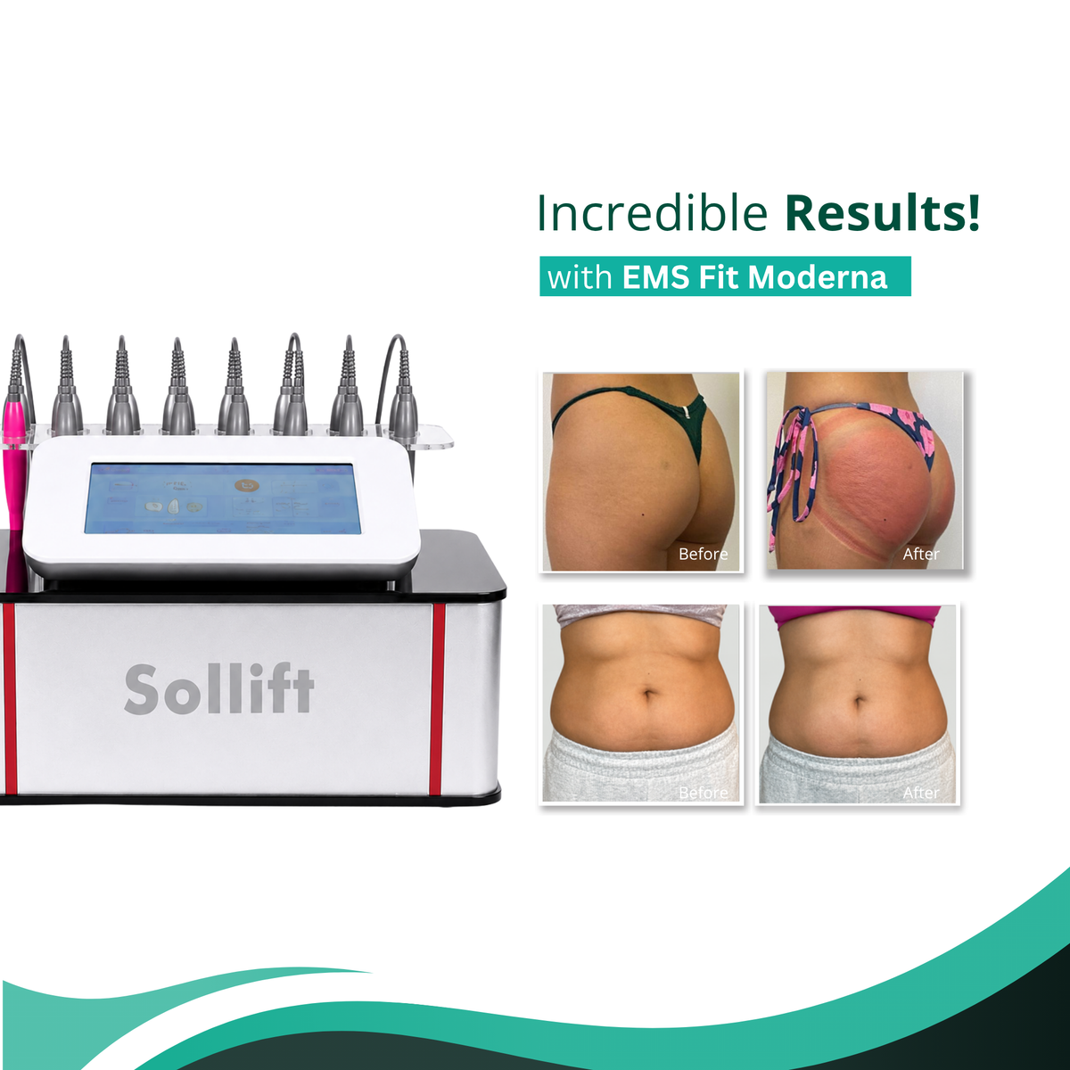 Fit Moderna EMS and Vacuum Cupping Therapy