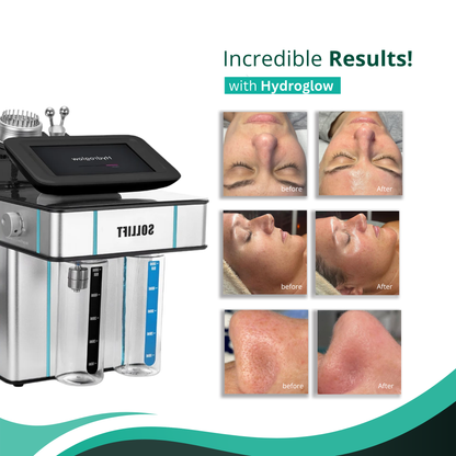 Hydroglow 3-in-1 Skin Brightening Facial System