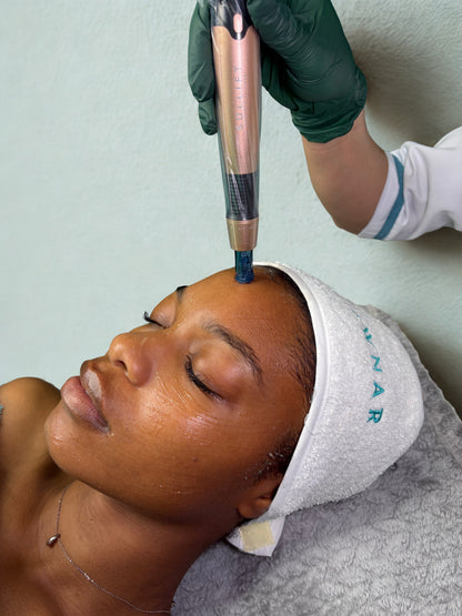 Velvet Microneedling Pen