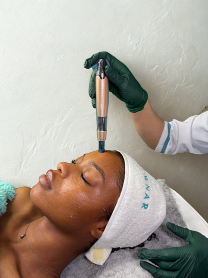 Velvet Microneedling Pen