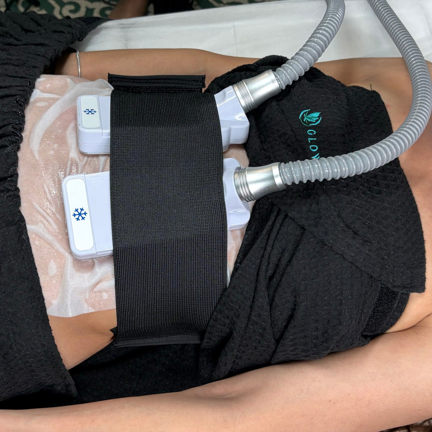 Cryo Tone Face and Body Contouring