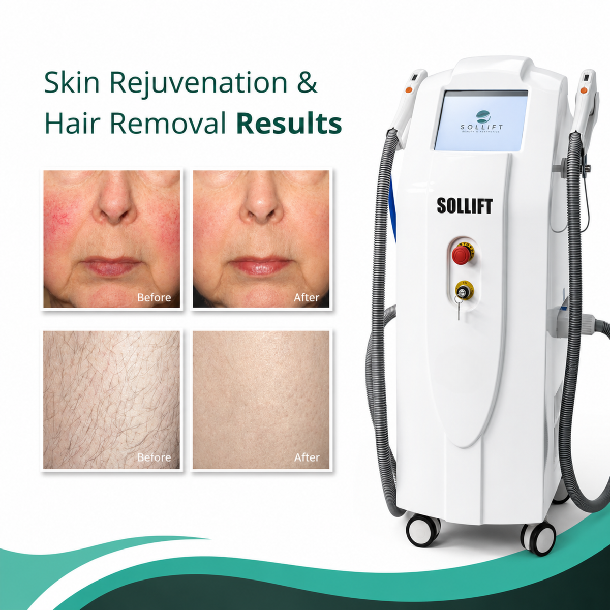 The Medi Next Advanced IPL Hair Removal and Skin Rejuvenation device (FDA-cleared)