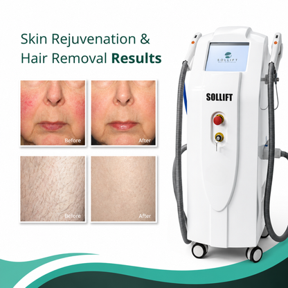 The Medi Next Advanced IPL Hair Removal and Skin Rejuvenation device (FDA-cleared)