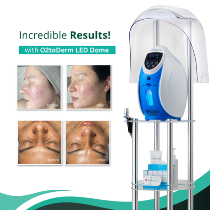 O2toDerm Oxygen + LED Dome (4 Colors)