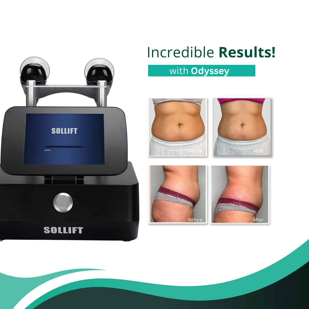 Clearance Odyssey Body Contouring System