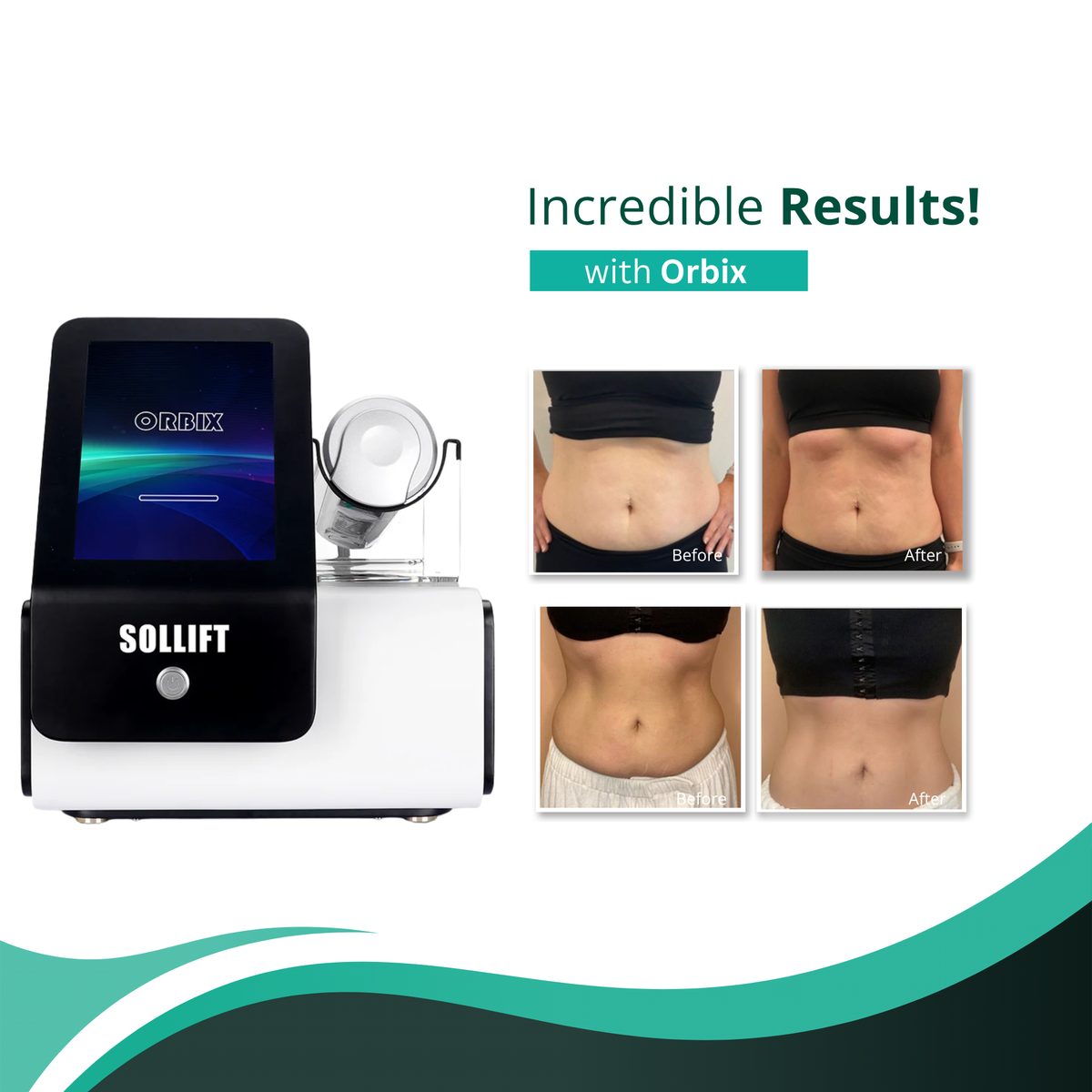 Orbix Body Sculpting Contouring & Facial Rejuvenation System