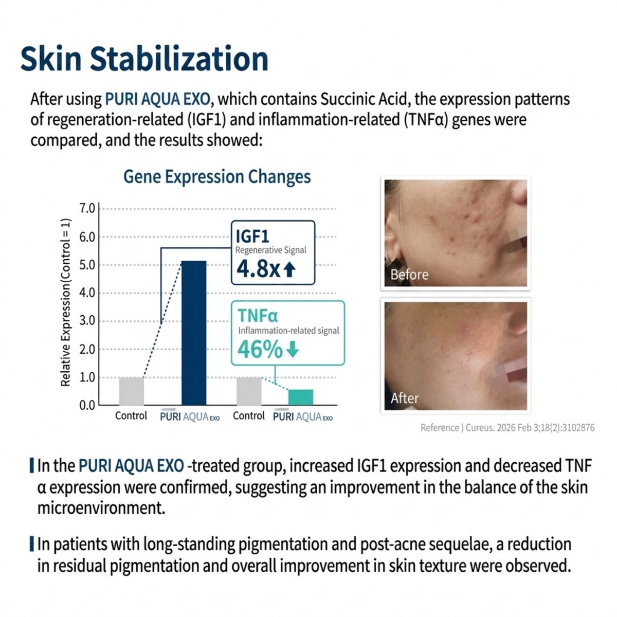 PURI AQUA EXO Exosome + Deep Hydration Skin Booster