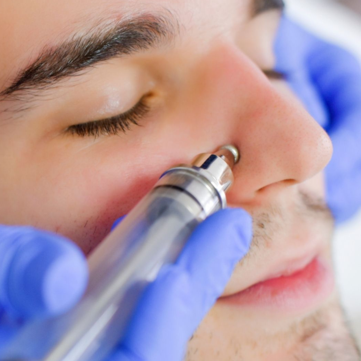 PureHydro® 2 in 1: Hydrodermabrasion and Wet Microdermabrasion