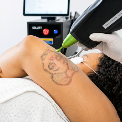 Revita Ink Remaster Tattoo Removal & Skin Rejuvenation Laser