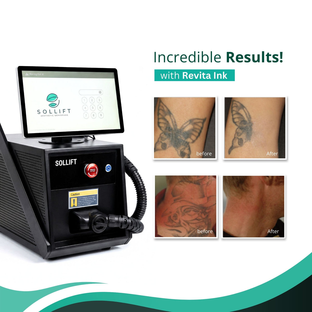 Revita Ink Remaster Tattoo Removal & Skin Rejuvenation Laser
