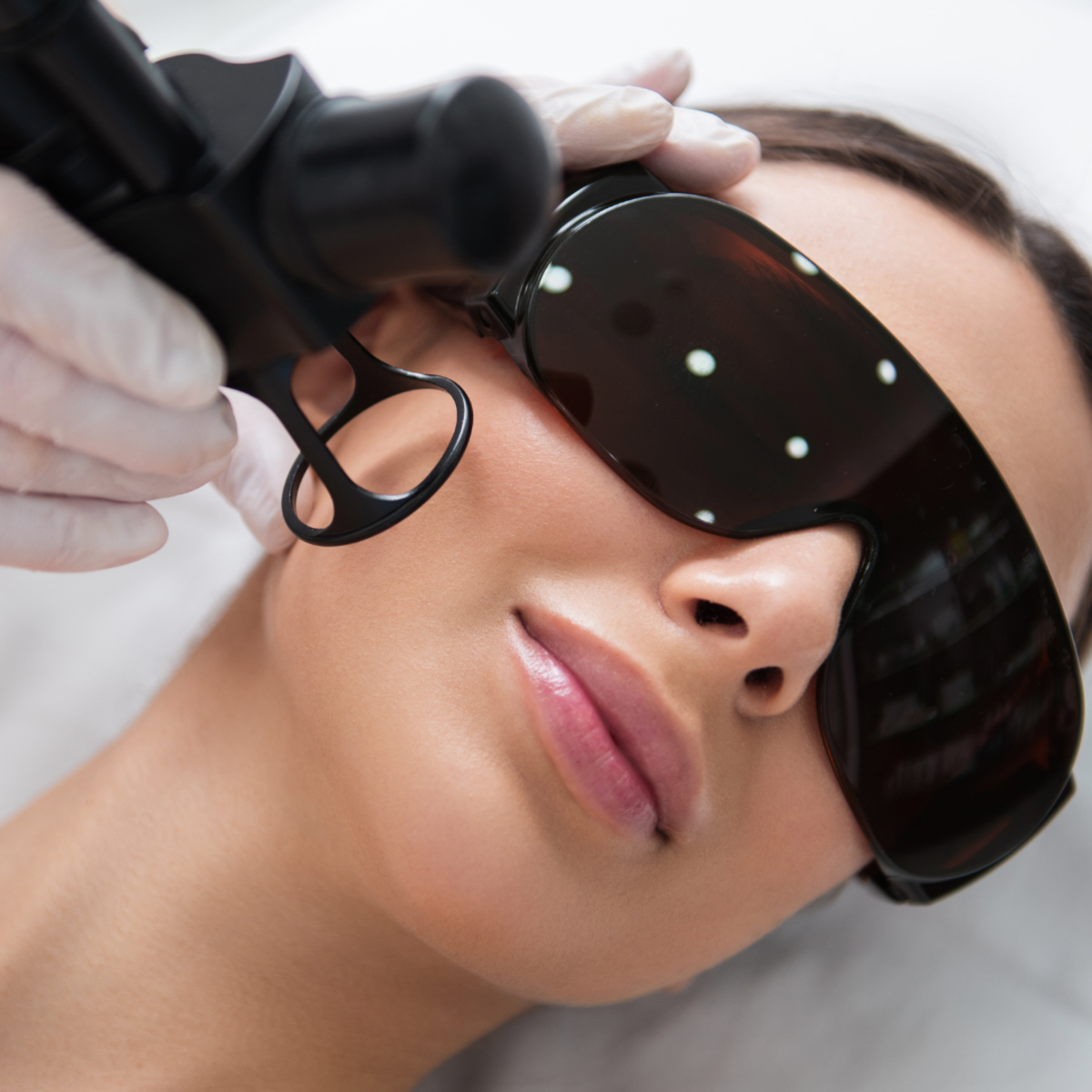 Silk Lotus CO2 Laser (FDA-cleared)