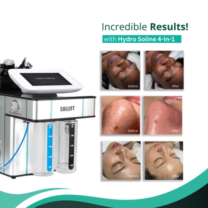 Hydro Soline 4-in-1 Skin Rejuvenation Facial Expert
