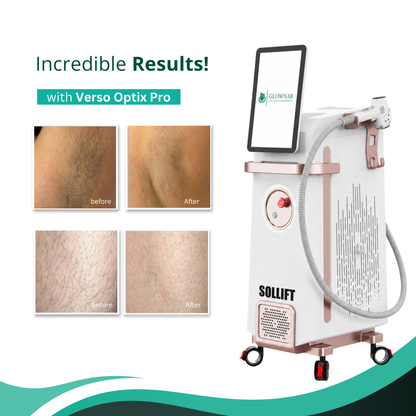 Verso Optix Pro 1.0 Diode Laser Hair Removal with Interchangeable Spot Size