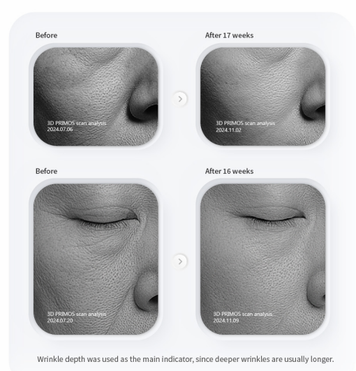 PURI PDRN Professional Skin Rejuvenation System