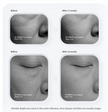 PURI PDRN Professional Skin Rejuvenation System