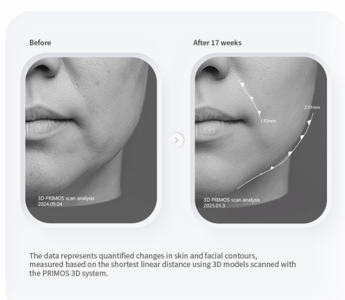 PURI PDRN Professional Skin Rejuvenation System