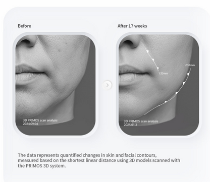 PURI PDRN Professional Skin Rejuvenation System