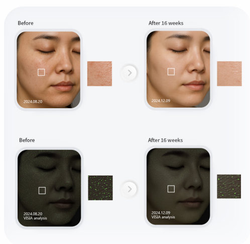 PURI PDRN Professional Skin Rejuvenation System