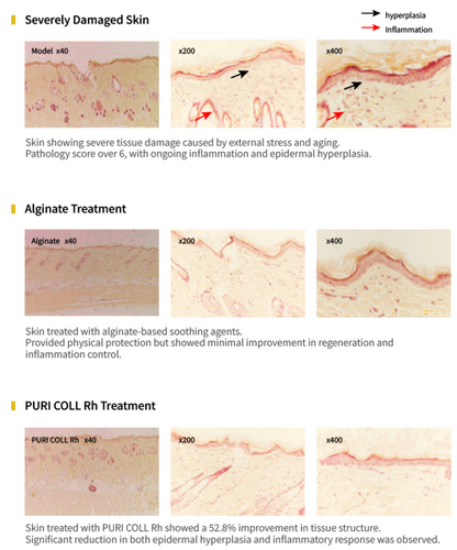 PURI COLL Rh – Recombinant Human Collagen Booster