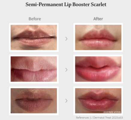 PURI LIPS – Hyaluronic Acid Lip Booster with B12