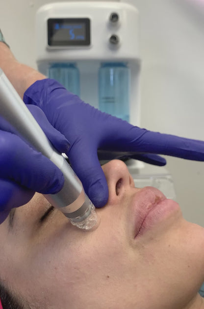 Tru Hydro 2-in-1 Hydro dermabrasion and Radiofrequency