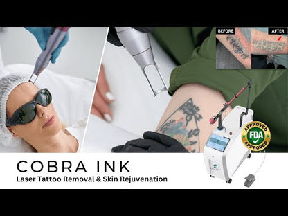 Cobra Ink Tattoo Removal System