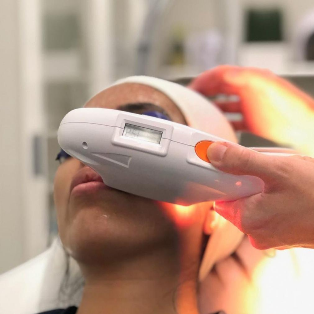 The Medi Next Advanced IPL System